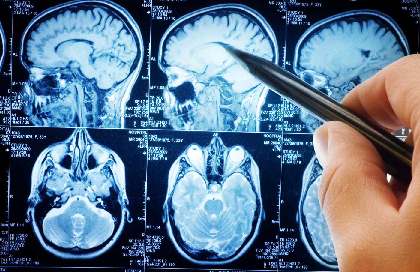brain connectivity