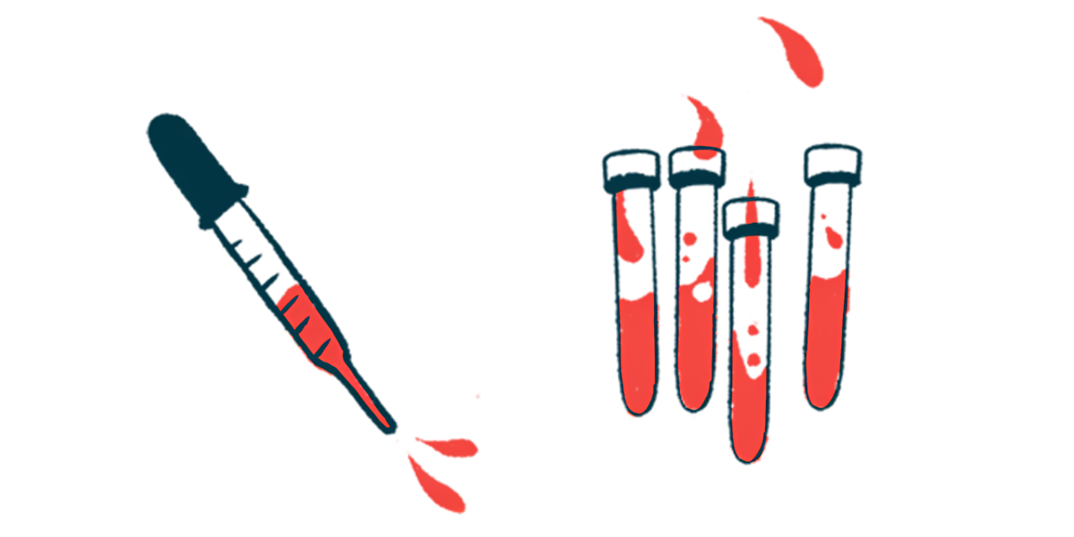 A dropper squirting blood is pictured alongside four half-filled vials.