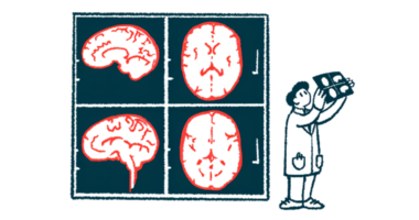 A researcher holds up an image of a brain scan that's projected in large size on a nearby wall.